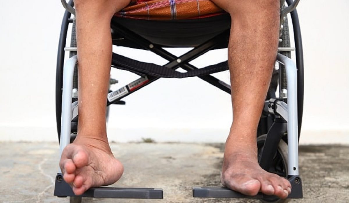 hari polio sedunia